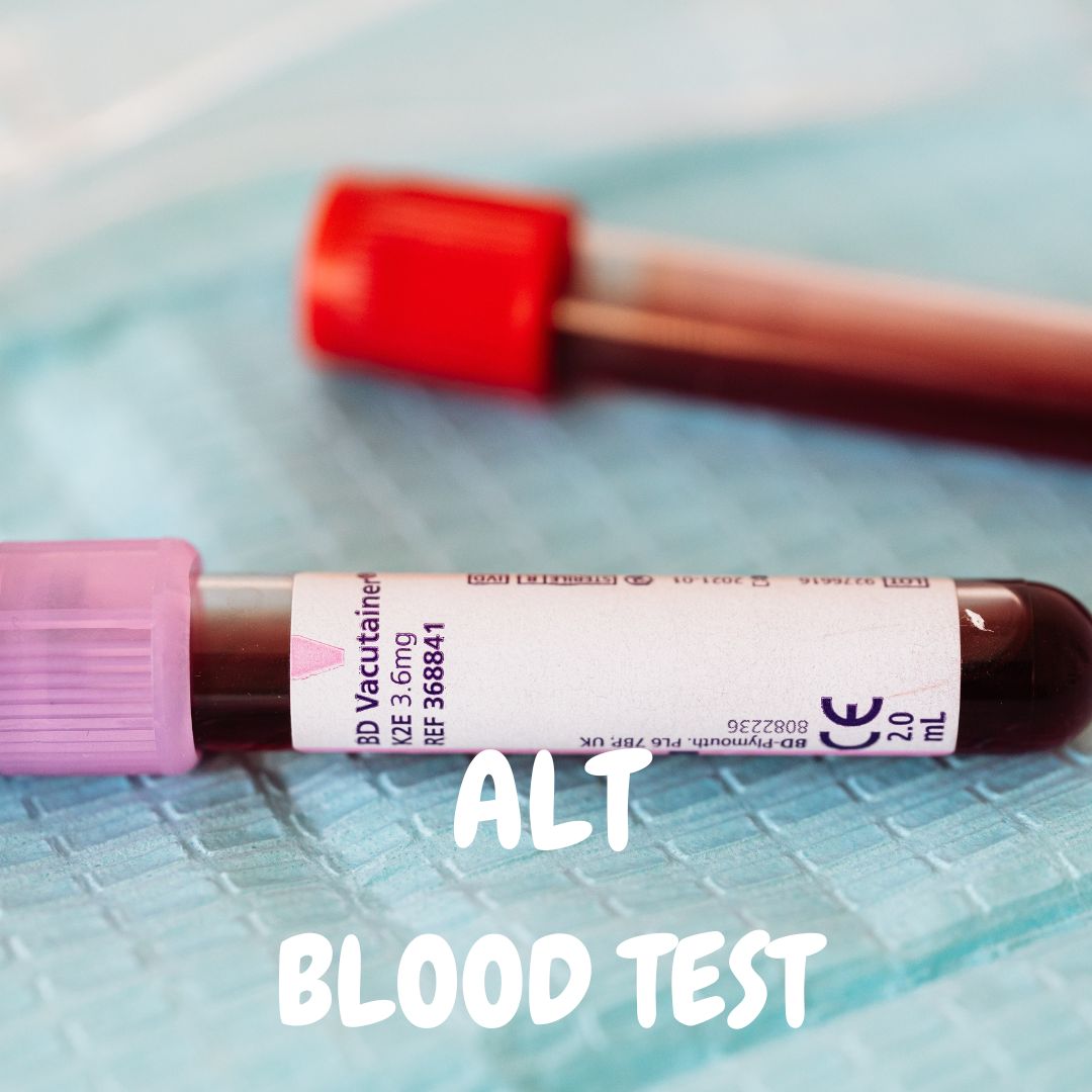 alanine-transaminase-alt-blood-test-bigman-lab