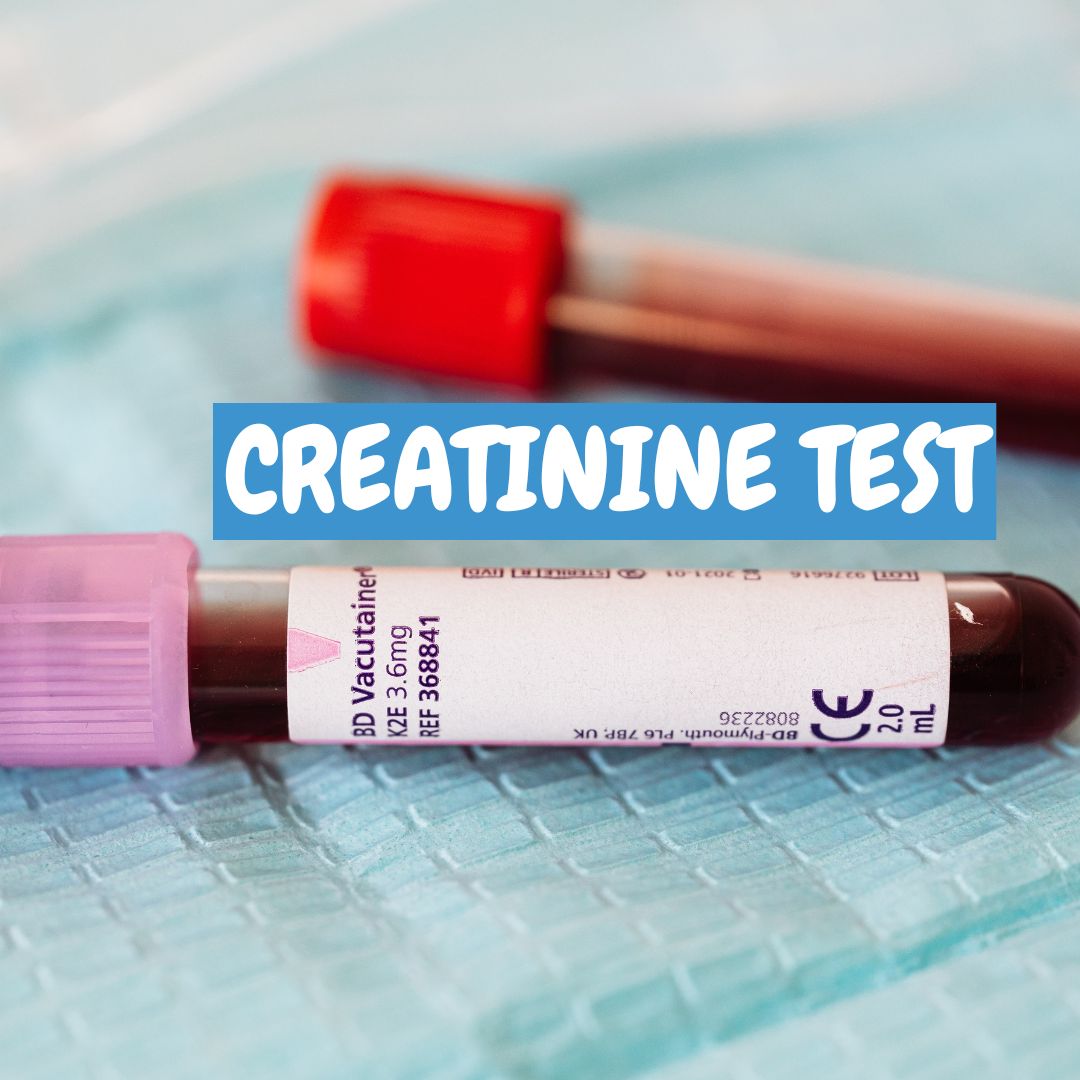 Creatinine Test: Serum, Clearance, Level - Bigman Lab