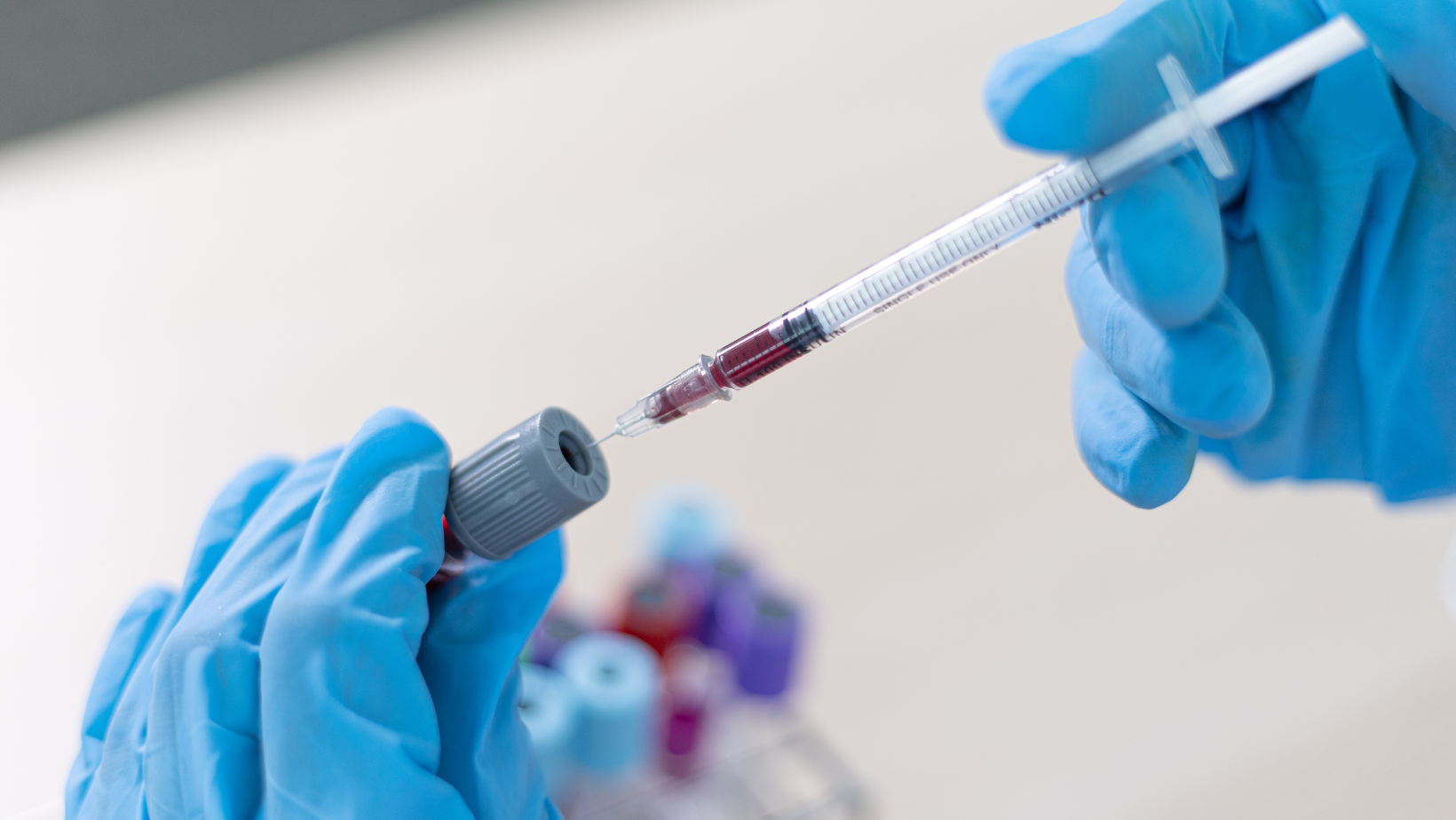 Liver Function Tests (LFT) - bigman lab