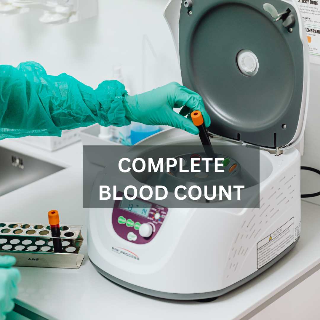 Best Complete Blood Count (CBC) Test Guide - bigman lab