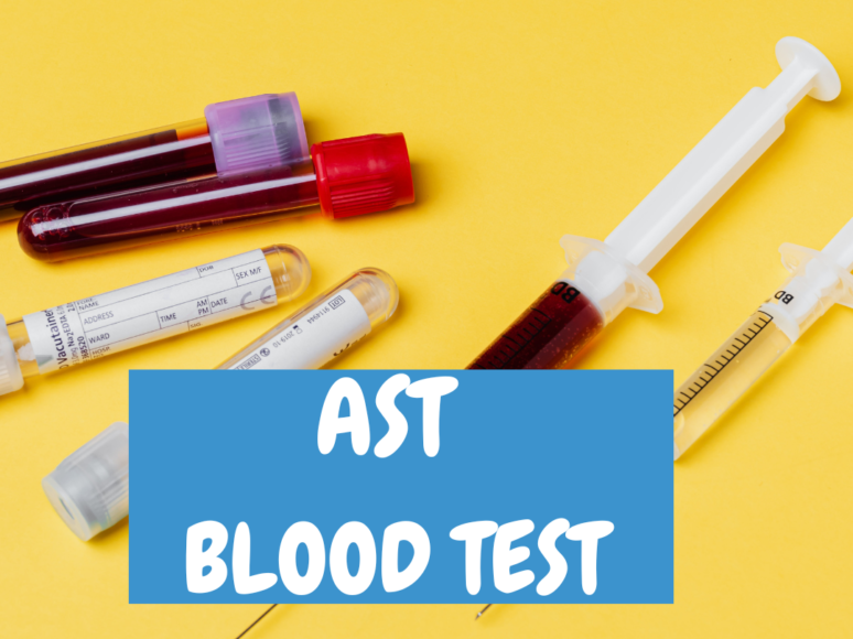 Creatinine Test: Serum, Clearance, Level - bigman lab